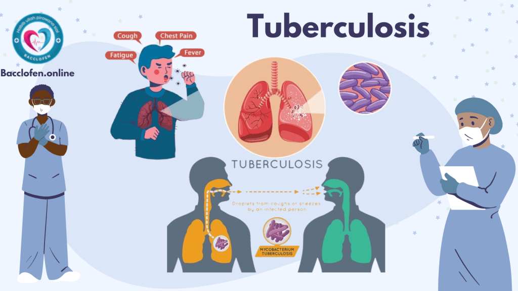 Tuberculosis: Causes,Symptoms,Diagnosis & Treatment