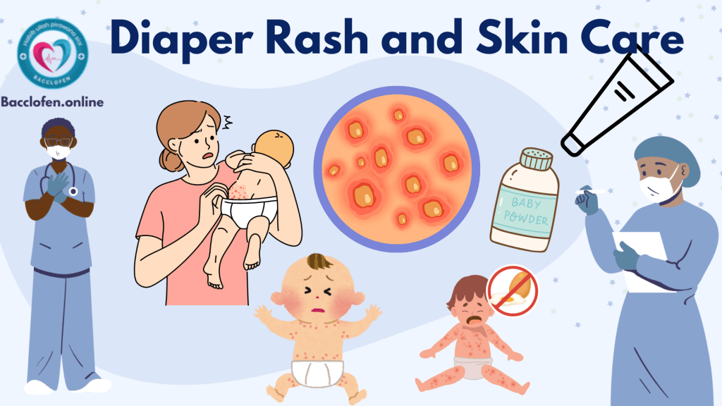 Diaper Rash and Skin Care for Infants Diaper Rash and Skin Care for Infants