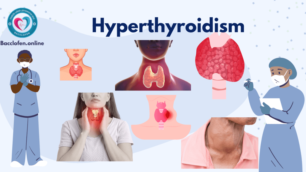 Hyperthyroidism: Causes, Symptoms, Prevention and Treatment Hyperthyroidism: Causes, Symptoms, Prevention, Diagnosis, and Treatment