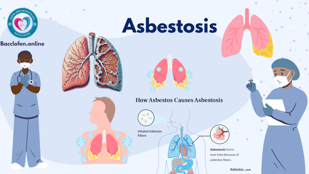 Asbestosis: Causes, Symptoms, Prevention and Treatment